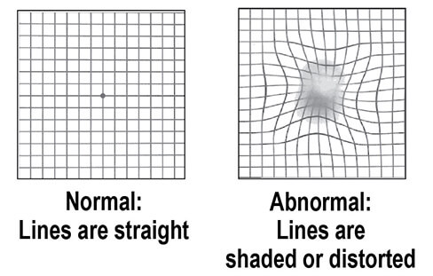 How AMD Damaged Vision