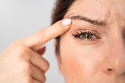 What Can I Do About My Droopy Eyelids? | VisionPoint Eye Center